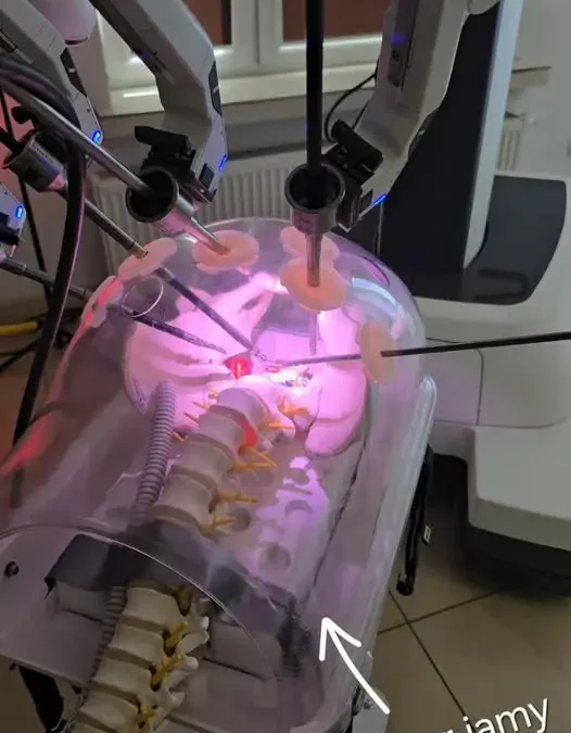 Robot Da Vinci w Kaliszu – szkolenie chirurgów z nową technologią