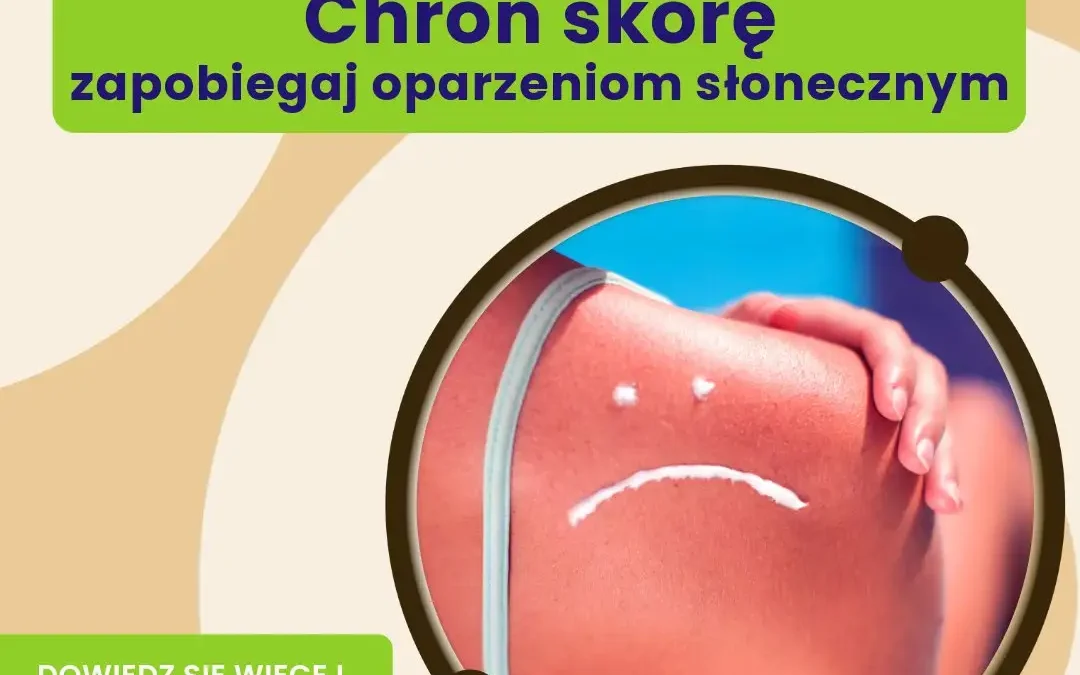 Jak chronić skórę przed słońcem? Poradnik NFZ